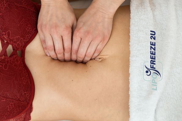 diastasis recti treatment Cheshunt