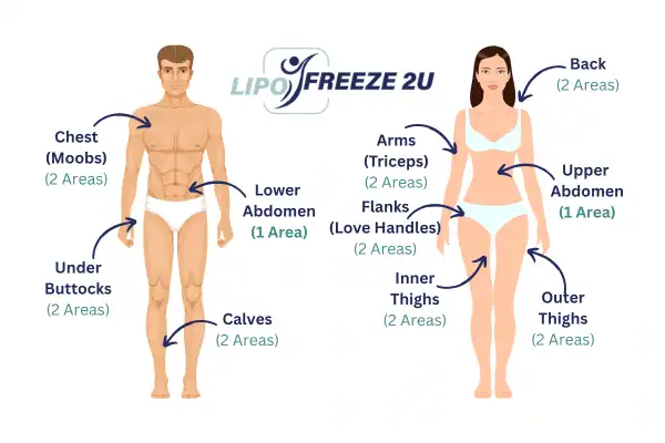 Areas you can have fat freezing treatment Cheshunt