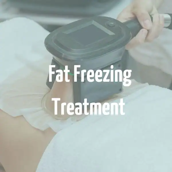 fat freezing treatment Cheshunt