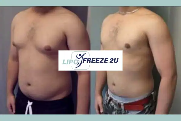 How Long Does It Take to See Results Cheshunt?
