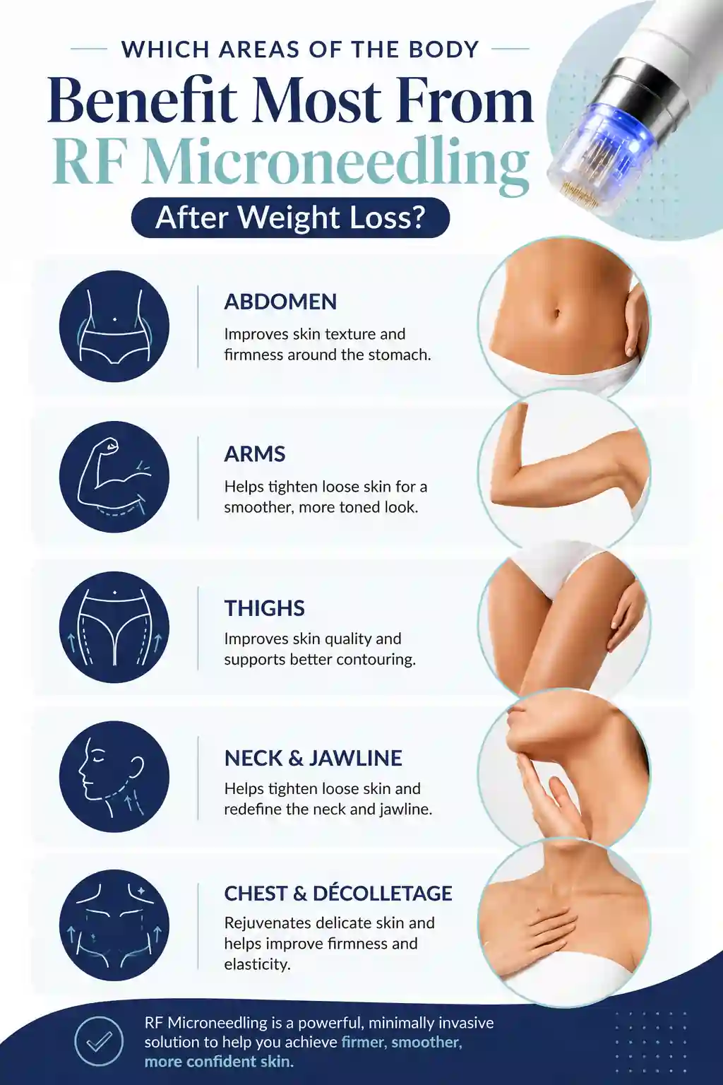 Which Areas of the Body Benefit Most From RF Microneedling After Weight Loss Cheshunt